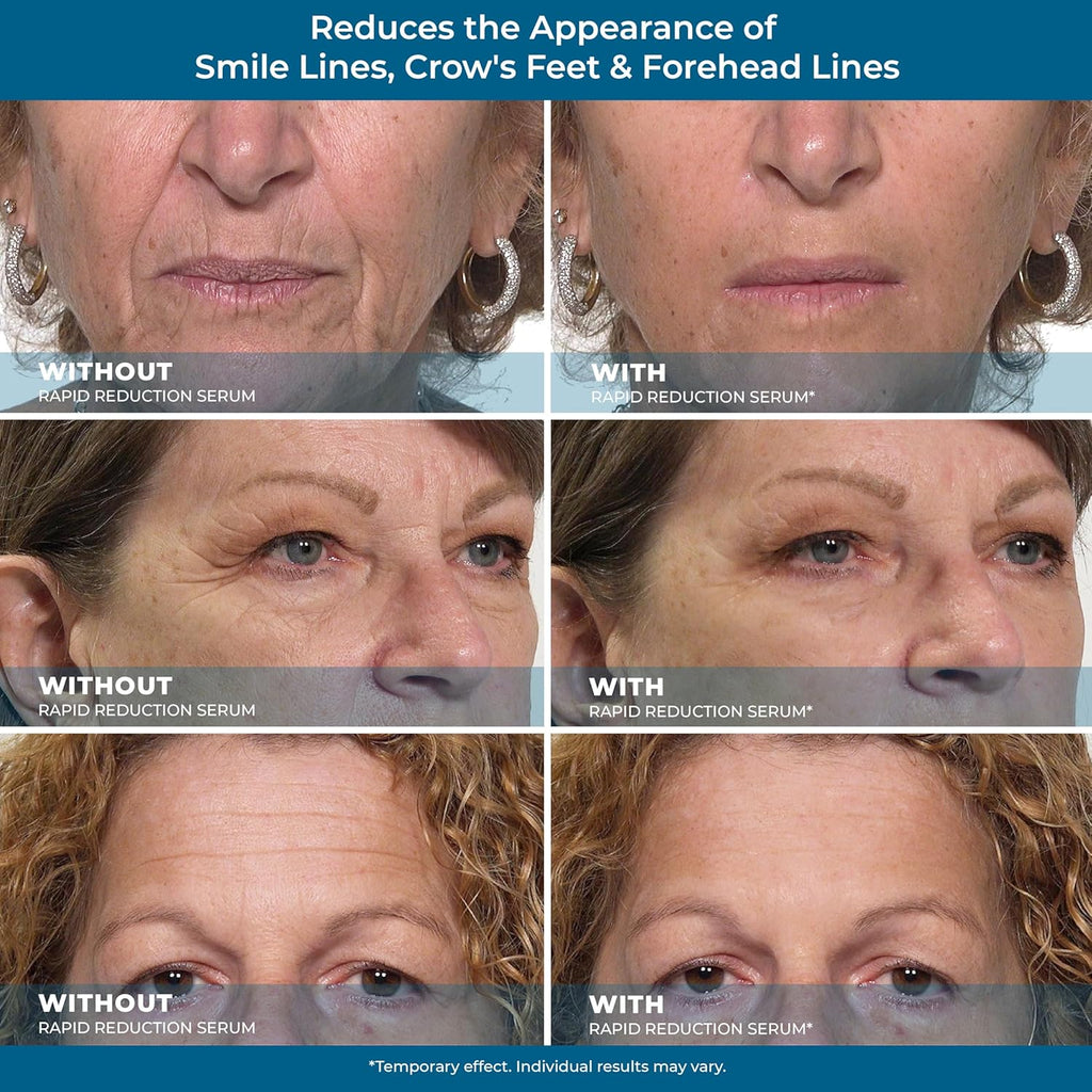 Rapid Reduction Eye Serum F9535